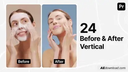 Before and After - Instagram Stories Premiere Pro template preview